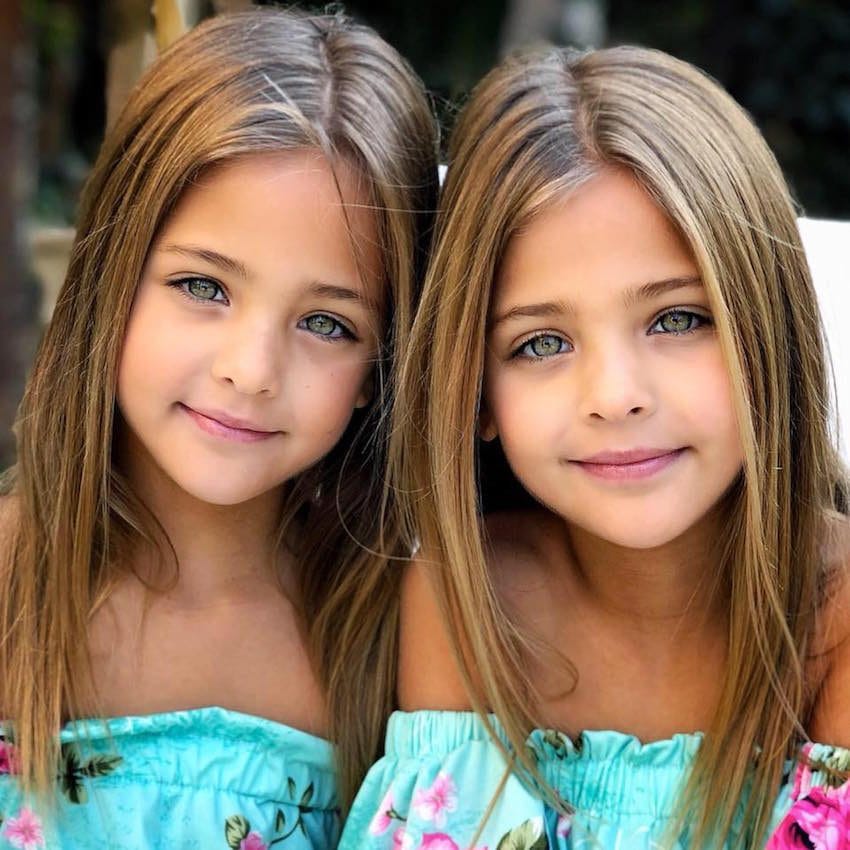 Most Beautiful Twins Baby Images Animaltree   The Most Beautiful Twins In The World 